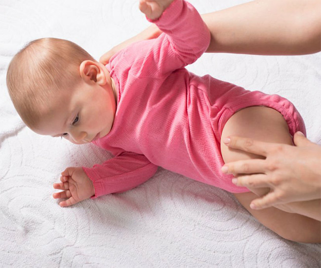 Understanding Baby Reflux Symptoms and Effective Treatments